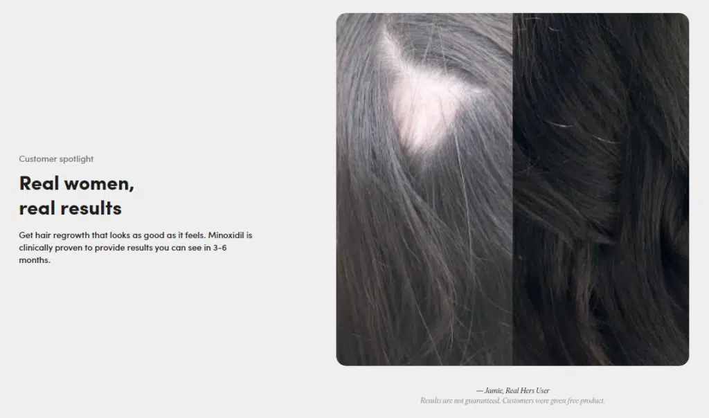 Product-Driven Vs. Customer-Driven: Hims &Amp; Hers